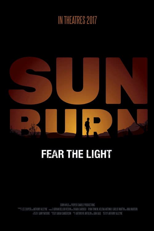 Sunburn
