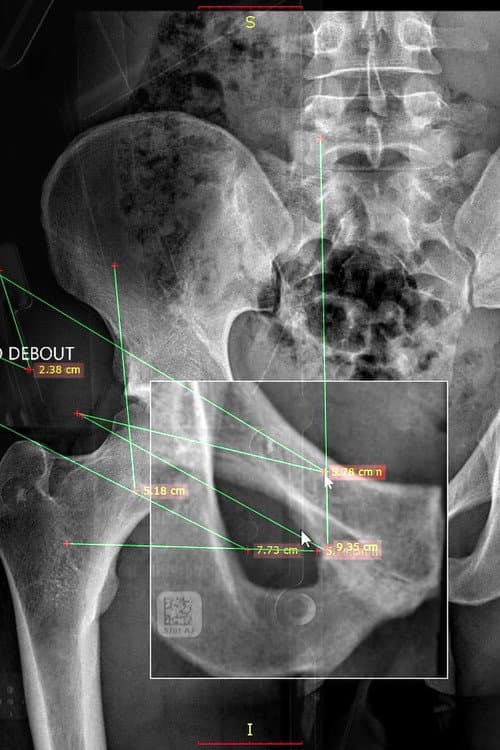 Autoportrait n° 2
